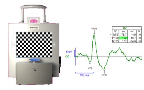 Erg Flash Pattern | metrovision erg and vep Erg Flash Pattern | metrovision erg and vep